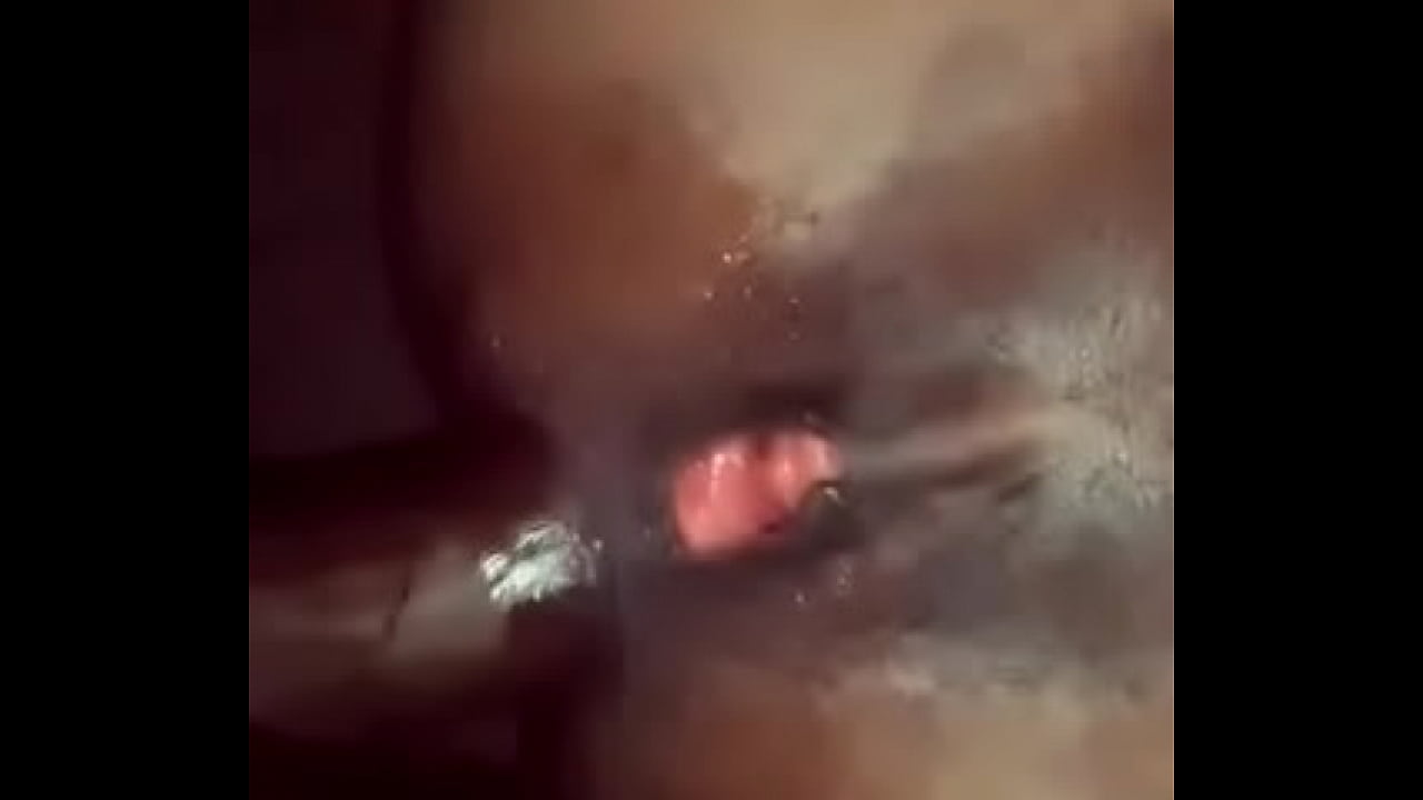 Mtoto Akichomeka Mwenyewe Mkunduni